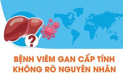[Infographic] - Bệnh vi&#234;m gan cấp t&#237;nh kh&#244;ng r&#245; nguy&#234;n nh&#226;n ở trẻ em