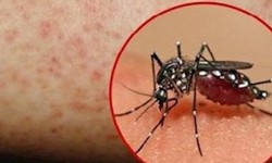 12 b&#224;i thuốc điều trị sốt xuất huyết