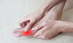 Dấu hiệu nhận biết gout cấp v&#224; c&#225;ch điều trị