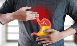 Giảm tr&#224;o ngược acid bằng c&#225;c biện ph&#225;p tại nh&#224;