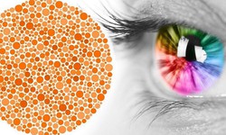 Biểu hiện của mù màu và cách khắc phục