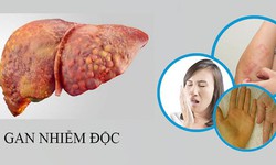 Thấy những biểu hiệu n&#224;y c&#243; thể gan bạn đ&#227; nhiễm độc