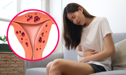 Đau v&#249;ng chậu ở phụ nữ l&#224; dấu hiệu bệnh g&#236;?