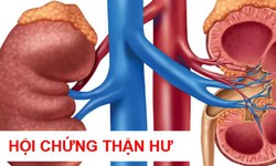 Hội chứng thận hư ở người lớn c&#243; nguy hiểm?