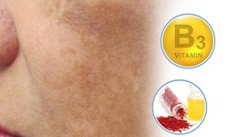 Cải thiện n&#225;m, s&#225;ng da với tinh chất nghệ t&#226;y v&#224; c&#225;c dưỡng chất l&#224;m đẹp
