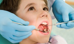 Biểu hiện s&#226;u răng sớm ở trẻ v&#224; c&#225;ch dự ph&#242;ng