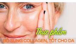 10 thực phẩm tốt nhất n&#234;n ăn tăng cường collagen, đ&#225;nh bay l&#224;n da nhăn nheo, chảy xệ