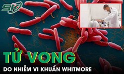 Một người ở Quảng Nam tử vong do nhiễm vi khuẩn Whitmore