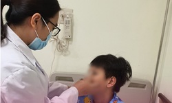Đồ long đao đập v&#224;o mặt, b&#233; 10 tuổi bị sưng nề, biến dạng v&#249;ng mũi