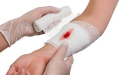 Chủ quan với c&#225;c vết xước nhỏ, nhiều người bị nhiễm tr&#249;ng nặng