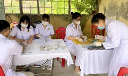 Ăn hải sản sống, hơn 50 người ở Quảng Ninh bị nhiễm s&#225;n l&#225; gan nhỏ