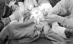 Bệnh viện Đa khoa B&#236;nh Dương &#39;t&#225;o bạo&#39; thực hiện kỹ thuật kh&#243;, gi&#250;p người bệnh giữ lại ch&#226;n đứt l&#236;a