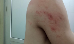 Người d&#226;n H&#224; Nội k&#234;u trời v&#236; kiến ba khoang ho&#224;nh h&#224;nh