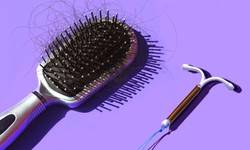 C&#225;c biện ph&#225;p tr&#225;nh thai c&#243; thể g&#226;y rụng t&#243;c?