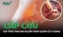 Kịp thời mổ cấp cứu thai nhi bị d&#226;y rốn quấn cổ 4 v&#242;ng