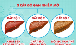 4 m&#243;n ăn b&#224;i thuốc ph&#242;ng trị gan nhiễm mỡ