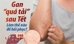 Gan &quot;qu&#225; tải&quot; sau Tết – L&#224;m thế n&#224;o để hồi phục?