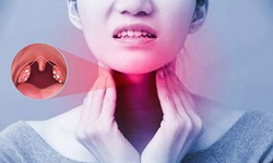 Viêm họng do liên cầu có triệu chứng gì?