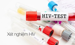 “N&#243;ng” t&#236;nh trạng l&#226;y nhiễm HIV trong nh&#243;m MSM ở Kh&#225;nh H&#242;a