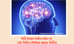 Rối loạn tuần hoàn não và những biến chứng nguy hiểm