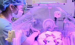Nghệ An nu&#244;i sống b&#233; sinh non 24 tuần tuổi, nặng vỏn vẹn 700 gram