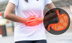 5 loại thực phẩm gi&#250;p trung h&#242;a axit, l&#224;m giảm cơn đau dạ d&#224;y