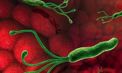 D&#249;ng thuốc tạo m&#224;ng bọc trong trị lo&#233;t dạ d&#224;y do vi khuẩn H.Pylori