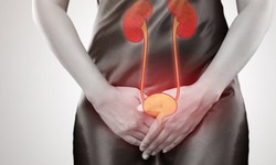 Biện ph&#225;p ngăn ngừa mất nước, ph&#242;ng bệnh tiết niệu trong m&#249;a h&#232;