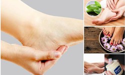 C&#225;ch hạn chế nứt g&#243;t ch&#226;n