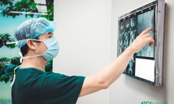 C&#225;ch lấy sạch 4 vi&#234;n sỏi thận k&#237;ch thước &quot;khủng&quot; trong 2 giờ