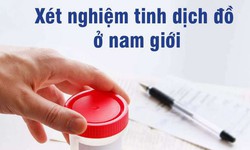 &#221; nghĩa c&#225;c chỉ số của x&#233;t nghiệm tinh dịch đồ khi chẩn đo&#225;n v&#244; sinh