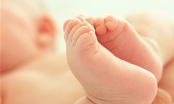 Tật thừa ng&#243;n tay, ng&#243;n ch&#226;n ở trẻ khi n&#224;o cần phẫu thuật?