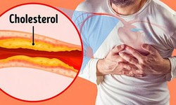 7 loại đồ uống giảm cholesterol tốt cho người tăng mỡ m&#225;u