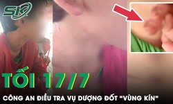 Công an điều tra vụ bố dượng bị tố đốt “vùng kín” con trai riêng của vợ ở An Giang