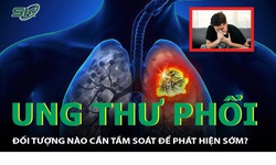 Bất ngờ ph&#225;t hiện ung thư phổi chỉ từ 3 dấu hiệu đơn giản