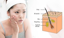 6 nguy&#234;n nh&#226;n g&#226;y da nhờn v&#224; c&#225;ch khắc phục tại nh&#224;