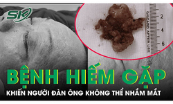 Kh&#244;ng thể nhắm mắt v&#236; căn bệnh hiếm gặp