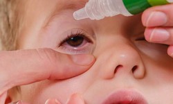 Sử dụng thuốc nhỏ mắt ở trẻ em đ&#250;ng c&#225;ch tại nh&#224;