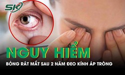 Mắt c&#244; g&#225;i &#39;kh&#244; như b&#224; l&#227;o&#39; do đeo k&#237;nh &#225;p tr&#242;ng