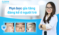 Mụn bọc gia tăng đ&#225;ng kể ở người trẻ