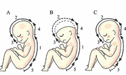Tầm quan trọng của Axit folic trong ph&#242;ng chống dị tật thai nhi