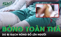 Gạch n&#243;ng đổ l&#234;n người khiến b&#233; trai bỏng nặng