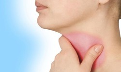 Viêm thanh quản có dẫn đến ung thư không?