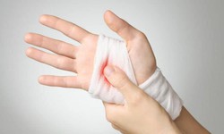 C&#225;ch sơ cứu cầm m&#225;u đ&#250;ng theo khuyến c&#225;o của b&#225;c sĩ