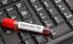 5 nh&#243;m người dễ bị thiếu vitamin B12