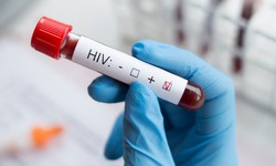 4 giải ph&#225;p thực hiện mục ti&#234;u x&#233;t nghiệm HIV đến năm 2030