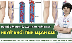 Huyết khối tĩnh mạch s&#226;u c&#243; thể g&#226;y đột tử, c&#225;ch n&#224;o ph&#225;t hiện?