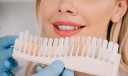 9 c&#225;ch để l&#224;m trắng răng bị ố v&#224;ng