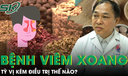 Chẩn bệnh vi&#234;m xoang theo Đ&#244;ng y: Tỳ vị k&#233;m điều trị thế n&#224;o? 
