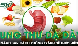 M&#225;ch bạn c&#225;ch ph&#242;ng tr&#225;nh ung thư dạ d&#224;y dễ thực hiện nhất